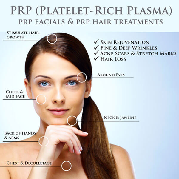 vampire facial prp facial