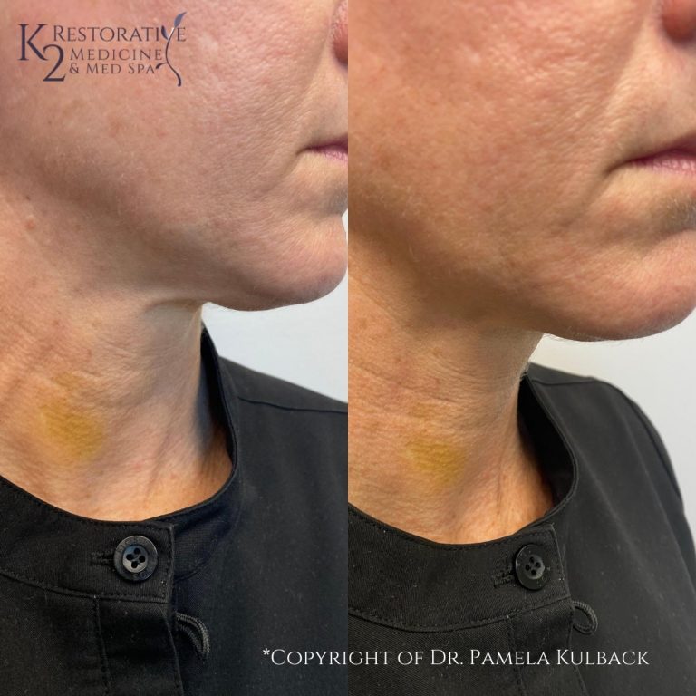 Browse our Before & After Gallery K2 Restorative Medicine