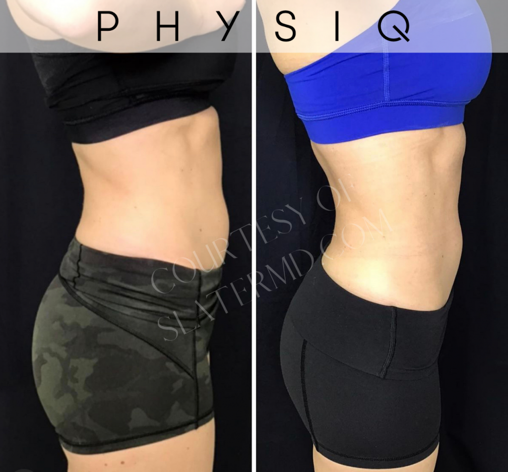 PHYSIQ BODY CONTOURING