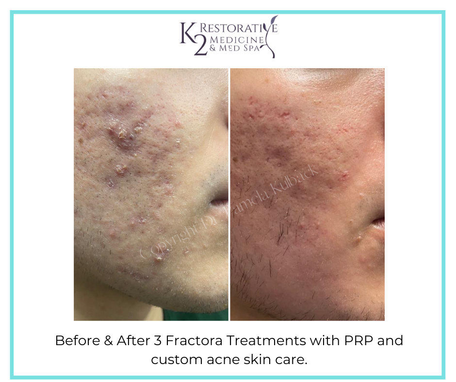 Before and after - K2 Restorative Medicine