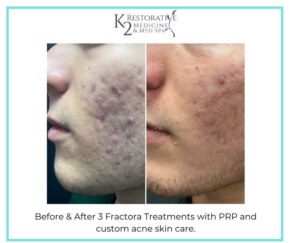 Before and after - K2 Restorative Medicine