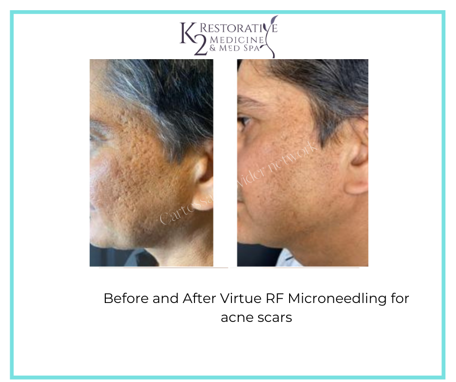 Before and after - K2 Restorative Medicine