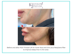 Browse our Before & After Gallery | K2 Restorative Medicine