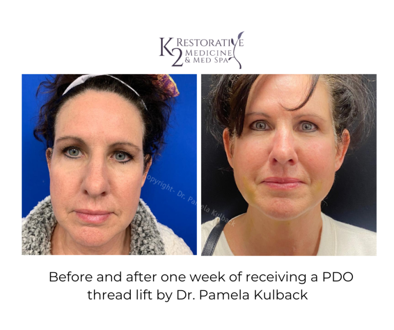 Browse our Before & After Gallery K2 Restorative Medicine