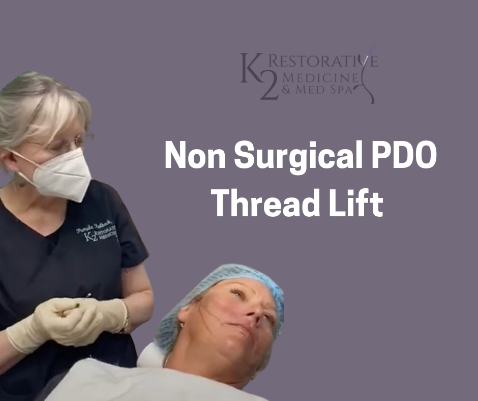 Non surgical -PDO thread lift at K2 restorative Medicine and Med Spa in Trussville, AL