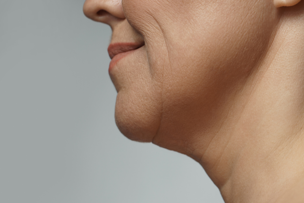 Effective saggy skin treatment near me in Trussville Alabama