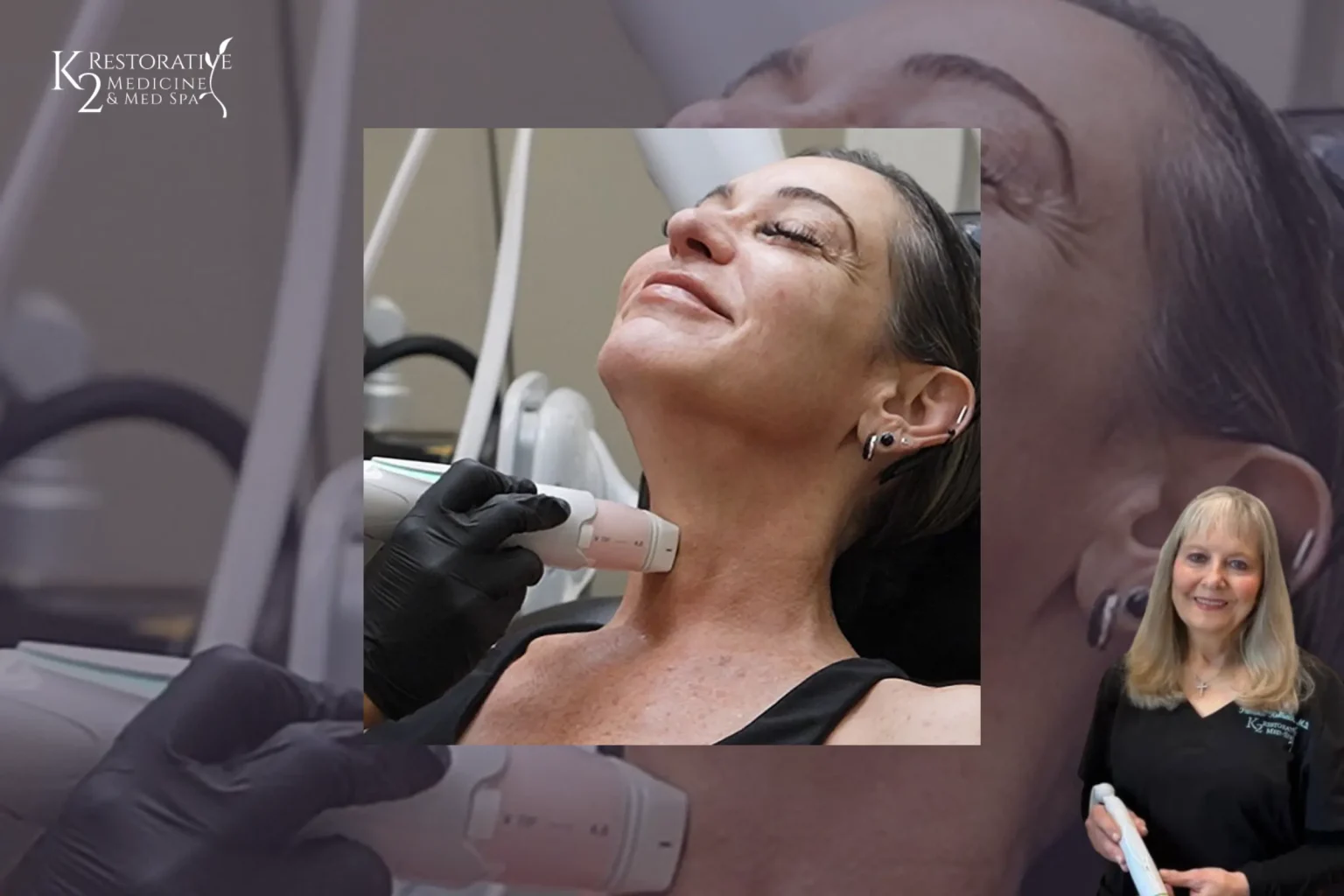 Everesse RF for Skin tightening at K2 Restorative Medicine and Med Spa