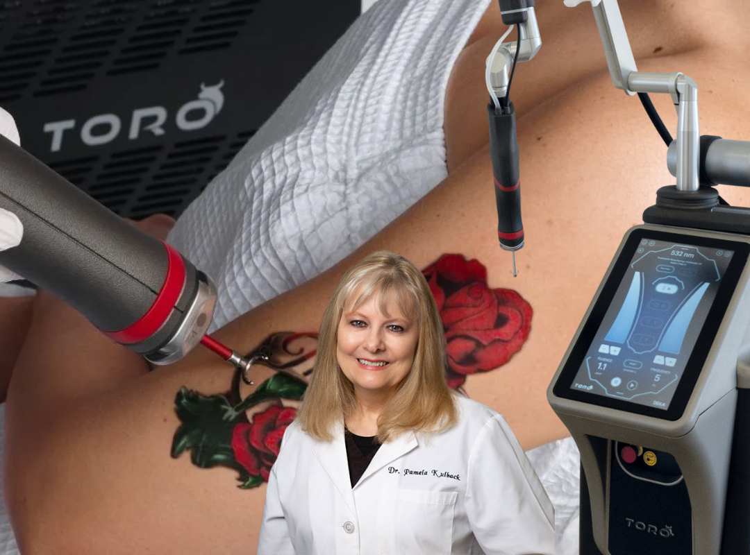 Toro Laser Tattoo Removal at K2 Restorative Medicine and Med Spa